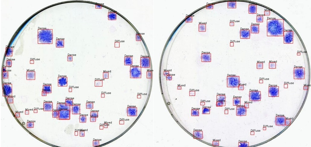 Colonies in Petri Dishes